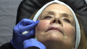 Read more about the article VOLUME 13: MASTERING THE USE OF COSMETIC INJECTIONS