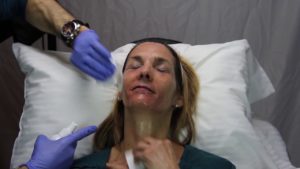 Read more about the article Volume 10 | CSFPS | Cosmetic Injections