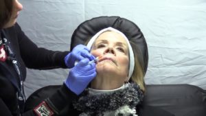 Read more about the article Volume 12 | CSFPS | Cosmetic Injections
