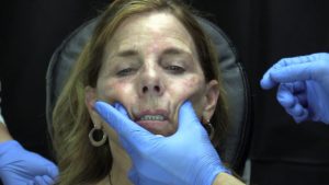 Read more about the article Volume 14 | CSFPS | Cosmetic Injections