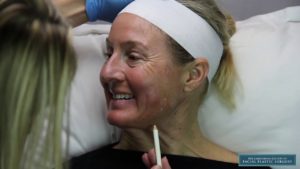 Read more about the article Volume 08 | CSFPS | Cosmetic Injections