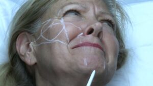 Read more about the article Tahoe 2024 Injections Video #1