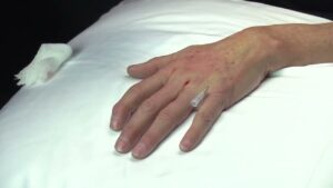 Read more about the article Tahoe 2024 Injections Video #10