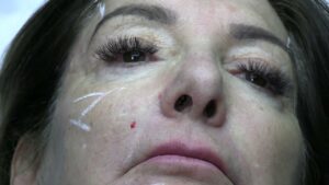Read more about the article Tahoe 2024 Injections Video #11