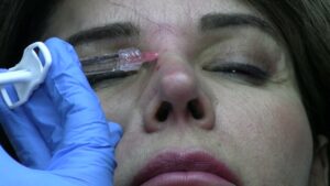 Read more about the article Tahoe 2024 Injections Video #12