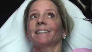 Read more about the article Tahoe 2024 Injections Video #5