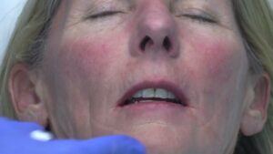 Read more about the article Tahoe 2024 Injections Video #7