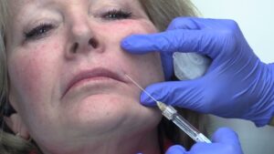 Read more about the article Tahoe 2024 Injections Video #8
