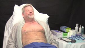 Read more about the article Allergan CoolSculpting Elite Demonstration – Saami Khalifian, M.D.