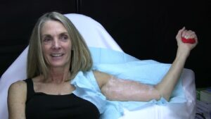 Read more about the article Sofwave Body Demonstration – Gregory Mueller, M.D.