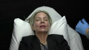 Read more about the article Sofwave +Carboxy Demonstration – Gregory Mueller, M.D.