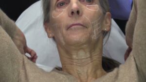 Read more about the article Injectables Demonstrations Tahoe 2025